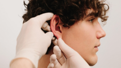 ear pinning