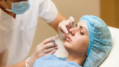 Septoplasty