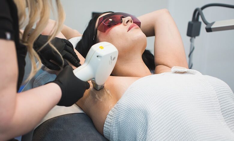 Laser Hair Removal