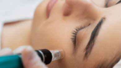 Hove Skin Clinic Options and Hair Loss Support for Women in Brighton